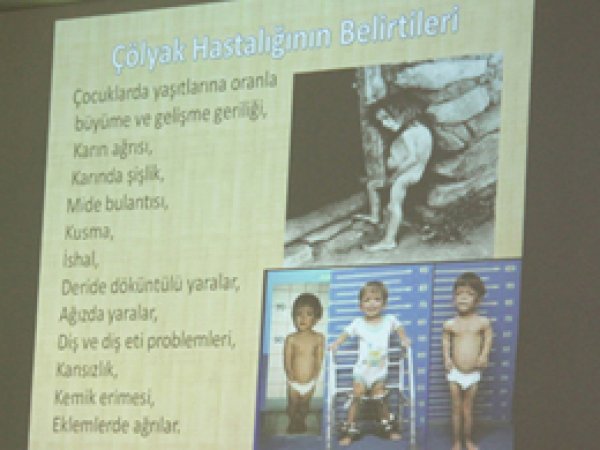 Çölyak Hastalığı Konusunda Bilgilendirme Yapıldı