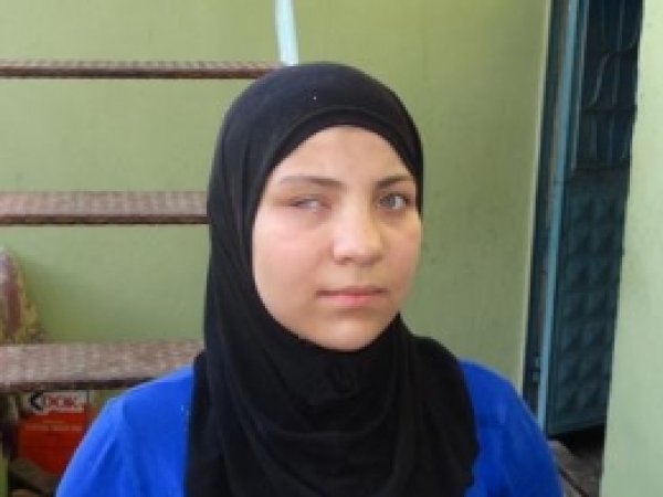 Suriyeli Kız Göz Protezi için Yardım Bekliyor