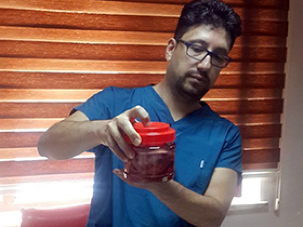 Çocuğun Böbreğinden 30 Gram Kist Çıktı