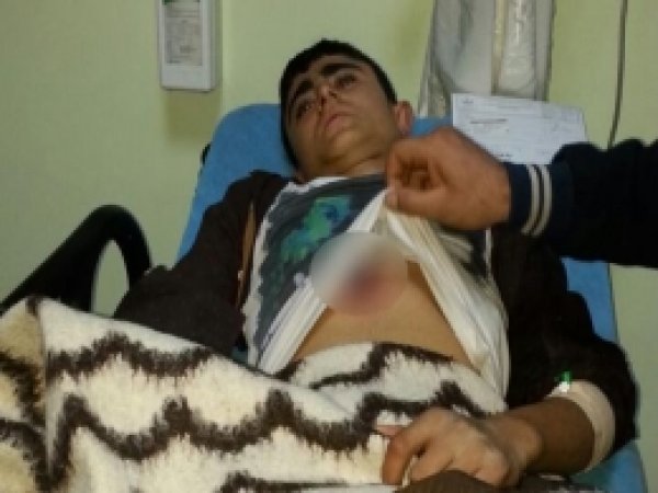 PKK'liler Polisle Çatıştı Masum Çocuk Yaralandı 