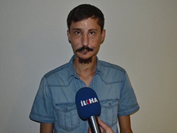 'Yüz Nakli Olduğum İçin Çok Mutluyum'
