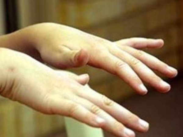 Fazla kafein tüketimi el titremesi sebebi