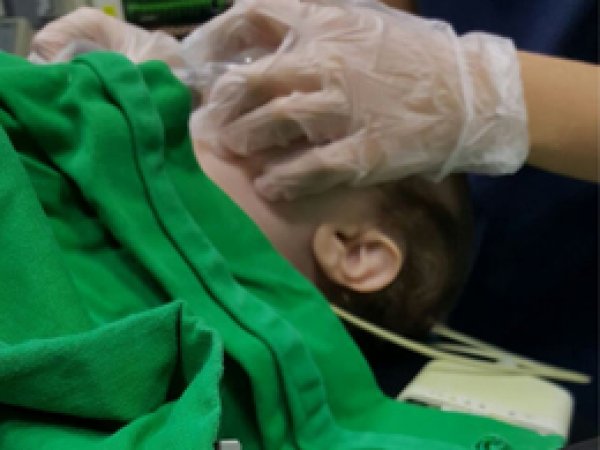 Tespih tanesini yutan bebek hayata döndürüldü