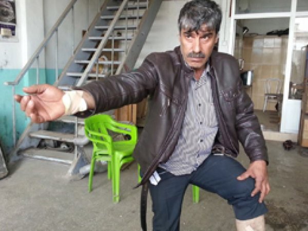İşe giderken sokak köpeklerinin saldırısına uğradı