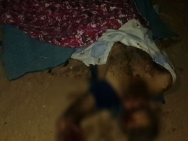 Patlayıcı yaparken ellerinde infilak etti: 3 yaralı