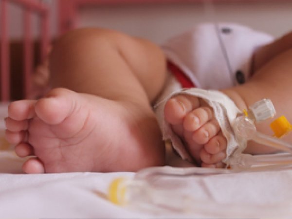 Kızıltepe'de 24 parmaklı 4 aylık bebek