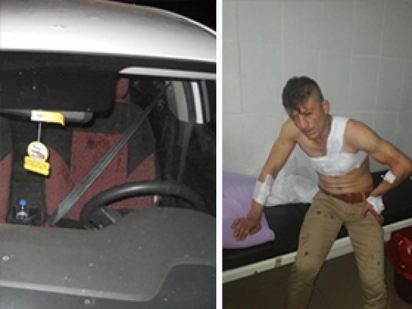 Derik'te sivil araca saldırı: 2 ölü, 3 yaralı