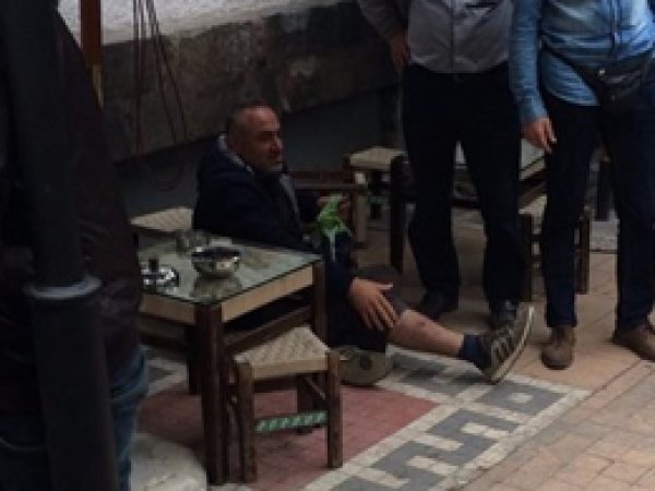 Epilasyon broşürü kavgası: 4 yaralı