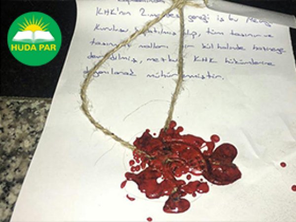 HÜDA PAR'dan basın özgürlüğü uyarısı