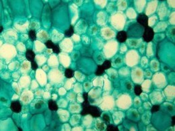 Yaşlanmayla ilgili protein keşfedildi 