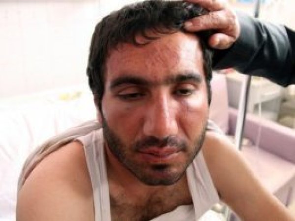 Alnında bot izi çıkaran dayak için karar