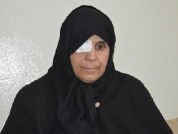 Suriyeli kadın ikinci gözünü de kaybetmek istemiyor