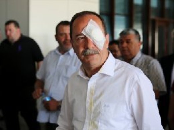 Belediye başkanına yumruklu saldırı 