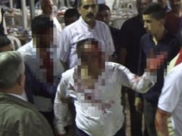 Husumetli aileler arasında kavga: 5 yaralı