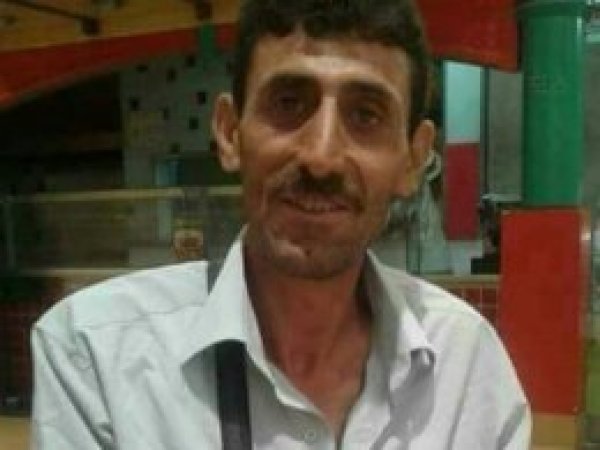 Arının sokması ölüm getirdi