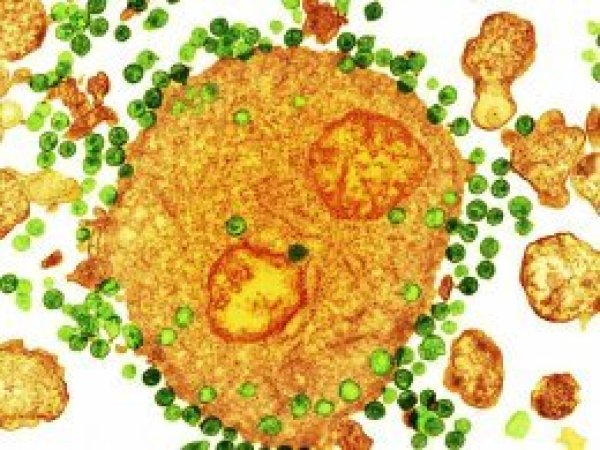 AIDS'ten kurtulan ikinci hasta: 'Londra hastası' 