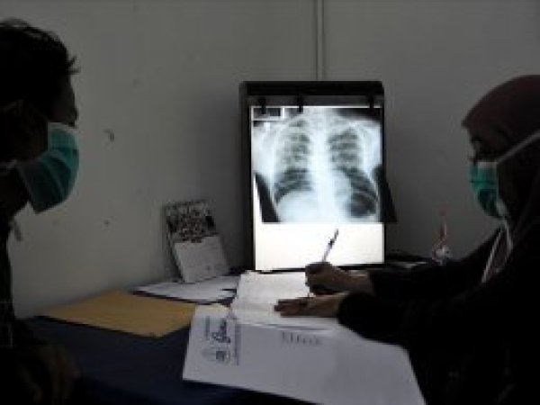 Dünyada her gün yaklaşık 4 bin 500 kişi veremden ölüyor