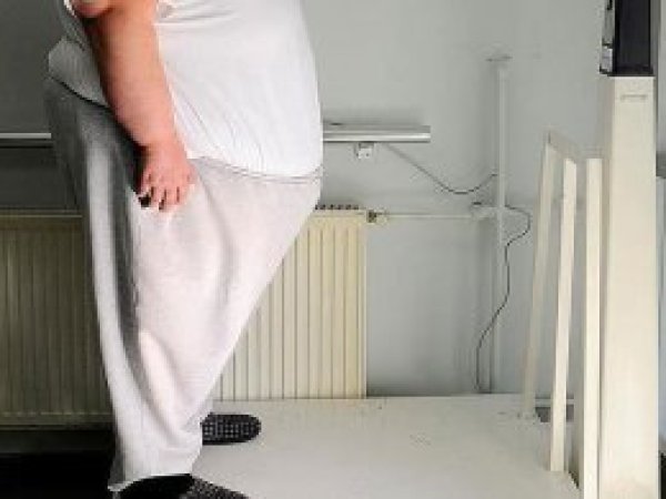 'Türkiye'de her üç kişiden biri obez'