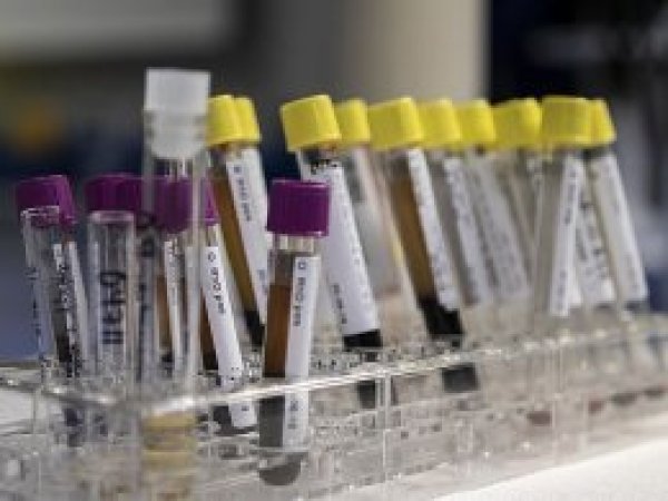 'Hepatit sebebiyle yılda 1,4 milyon kişi ölüyor'