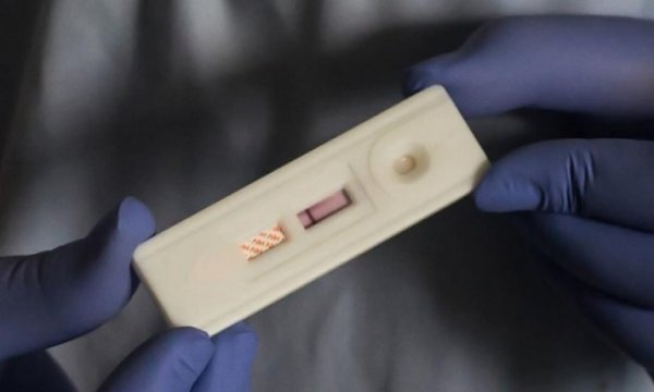 Nijerya'da 1,6 milyon AIDS sebebiyle öldü