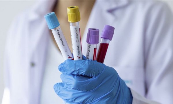 Dünya Sağlık Örgütü: Koronavirüs aşısı minimum 12-18 ay uzakta