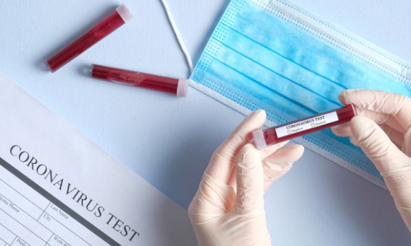 Koronavirüste vaka tanımı değişti: Sadece öksürüğü olana da test yapılacak