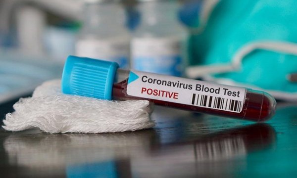Dünya genelinde Kovid-19'dan iyileşen kişi sayısı 330 bini aştı