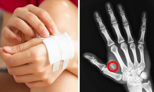 Kimlik kartı kredi kartı gibi fonsiyonları olan çip yaygınlaşıyor