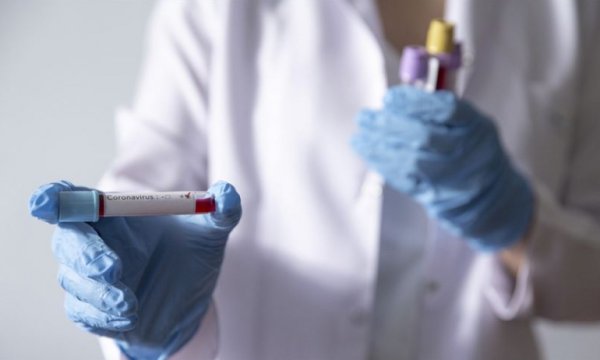 Kovid-19'dan iyileşme hızla artıyor iyleşen işi sayısı 2,5 milyonu aştı