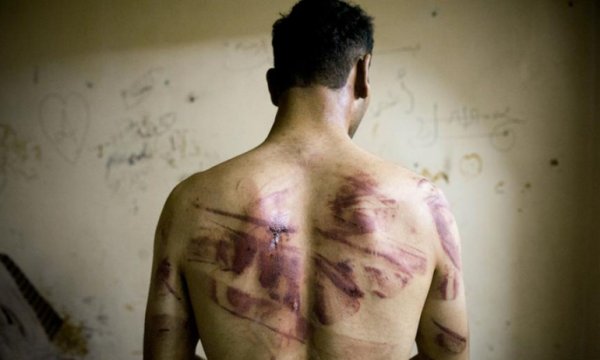 İşkence Özel Raportörü: İnsan haklarındaki erozyon endişe verici