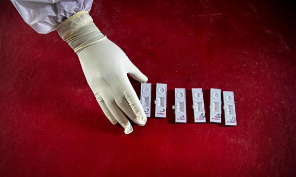 Covid-19 testinin pozitif sonuçları neden yanıltıcı olabilir?