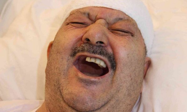 Diş ağrısı sanıp 6 sağlam dişini çektirdi, 18 yıl sonra 'delirten hastalık' teşhisi konuldu
