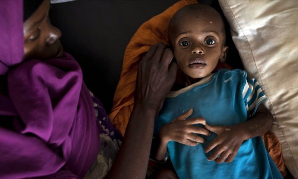 Oxfam: Doğu Afrika'da her 36 saniyede bir kişi açlıktan ölebilir 