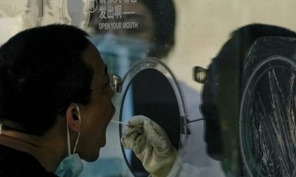Araştırma: Sars-CoV-2 yüzde 99,9 laboratuvar kaynaklı
