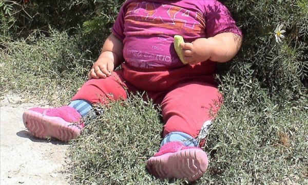 Aileler çocuklarındaki obezitenin büyüyünce geçeceğini düşünüyor