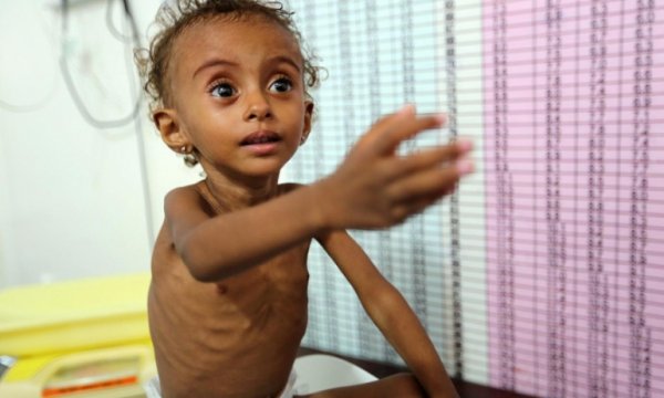 Kızıl Haç: Yemenlilerin %70'inden fazlasının insani yardıma ihtiyacı var