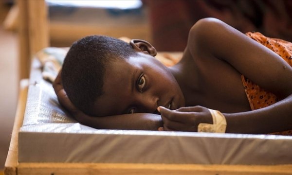 Kamerun’da  kolera salgınında vaka sayısında artış sürüyor
