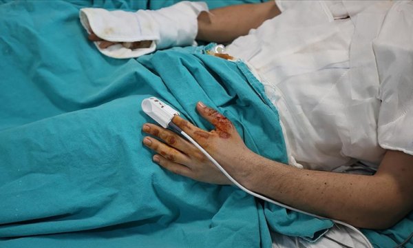 Evdeki anlık dikkatsizlik hasarı ömür boyu taşınabilecek ağır yanıklara yol açabiliyor