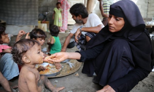 13 Milyon Yemenli açlıktan ve yetersiz beslenmeden dolayı acı çekiyor