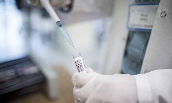 10 soruda 'maymun çiçeği' hastalığı