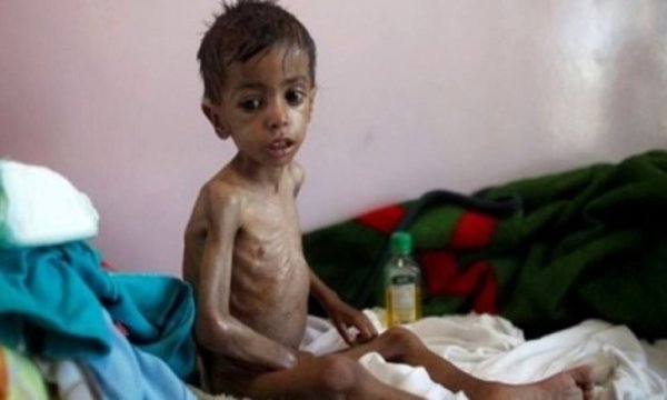 UNICEF Yemen'deki insani felaket konusunda uyarıda bulundu