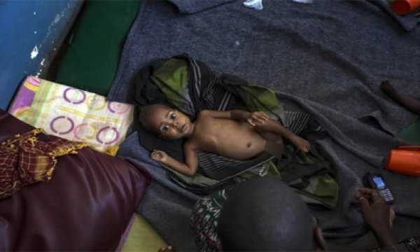 Somali’de çocuklar açlıktan ölüyor!