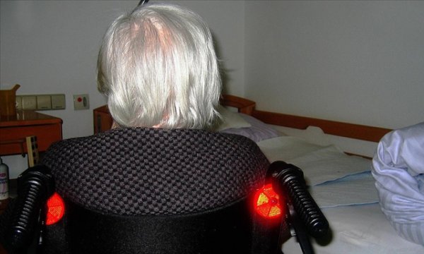 Almanya'da yatarak tedavi gören Alzheimer hasta sayısı 20 yılda iki kattan fazla arttı