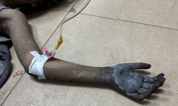'Filistin, İsrail için bir laboratuvar'