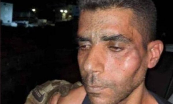 İsrail cezaevinde Filistinli mahkuma işkence