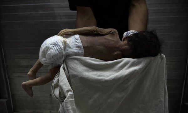Gazze'de bebek ölümleri ve doğum kusurları artıyor 