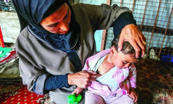 Gazze'de cilt hastalıkları hızla yayılıyor 