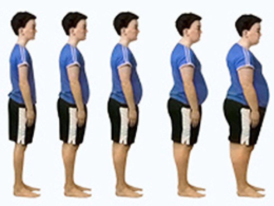 Obezite Nedir?