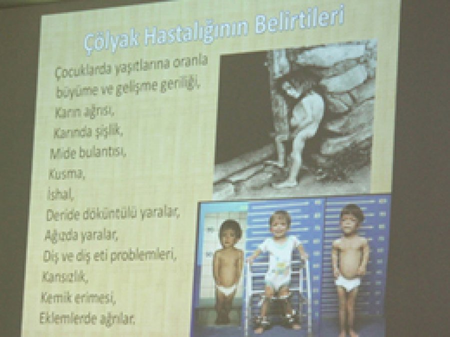 Çölyak Hastalığı Konusunda Bilgilendirme Yapıldı