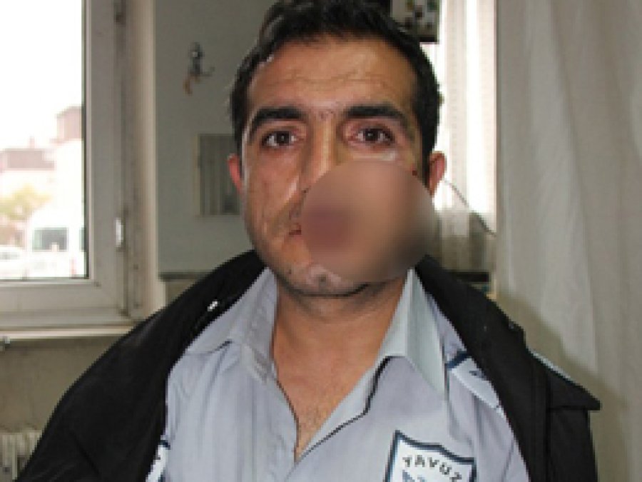 Uzman Çavuş, Güvenlikçiyi Darp Etti İddiası